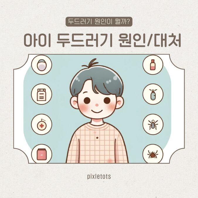 아이두드러기